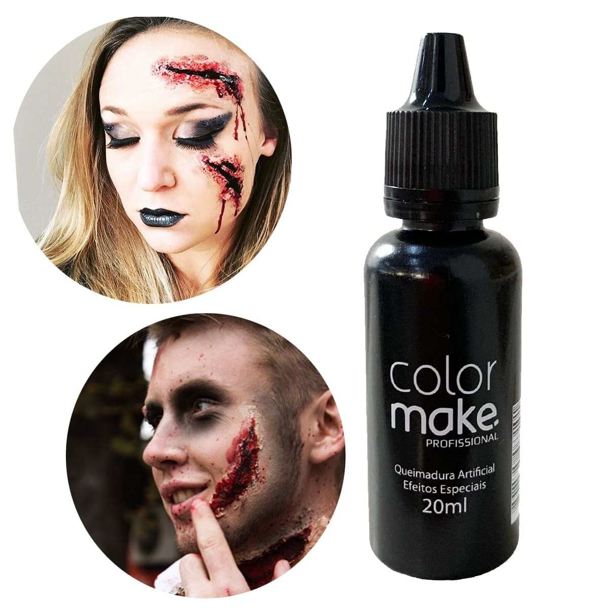 QUEIMADURA ARTIFICIAL